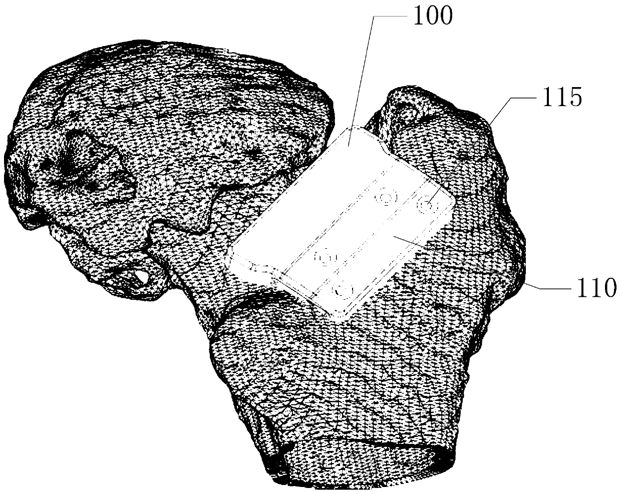 Cut-bone guide plate