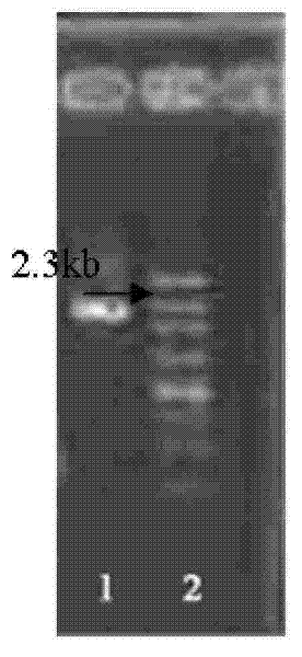 Recombined bifidobacteria hRV-VP4 expression vector and oral vaccine thereof