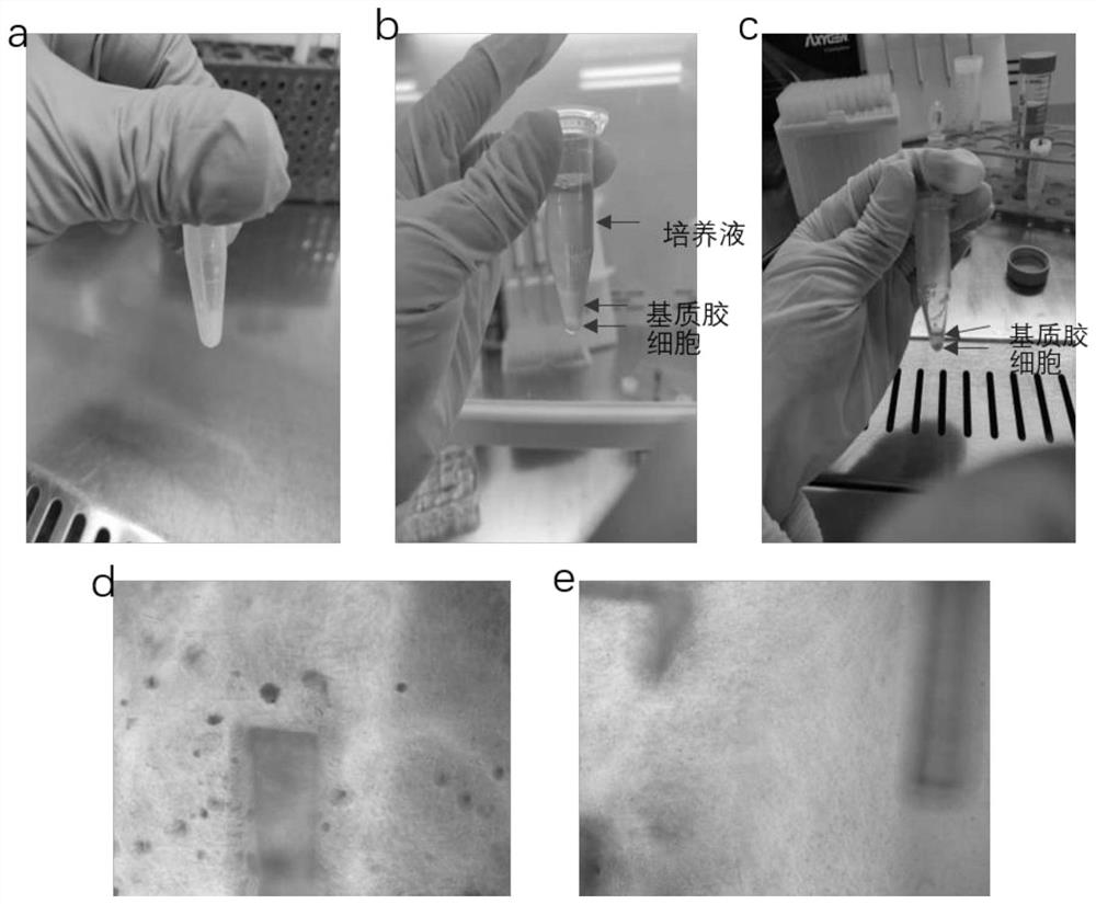 Culture method of breast cancer organoid and co-culture method of tumor-associated fibroblasts