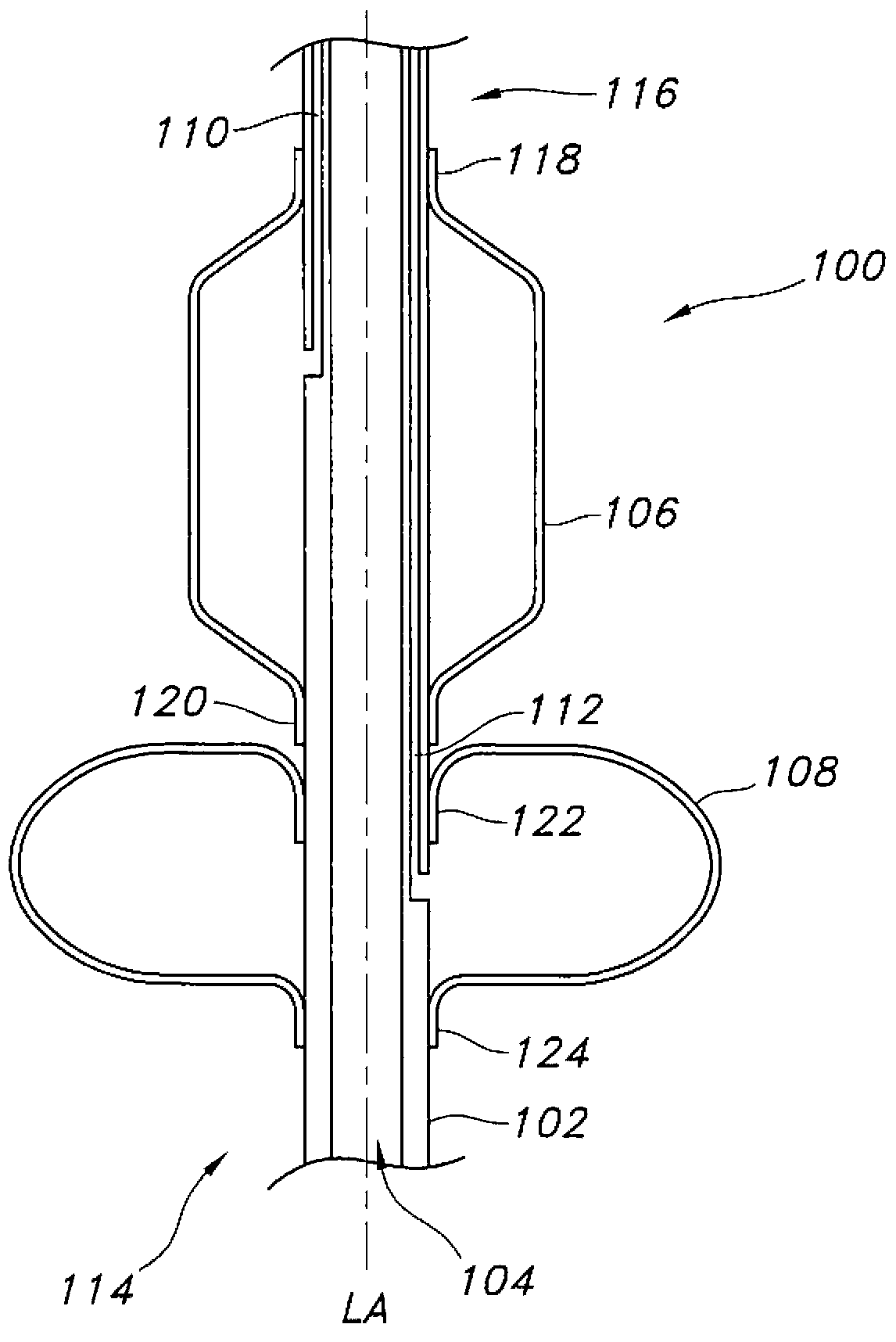 Multi-balloon dilation device for placing catheter tubes