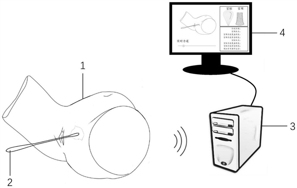 A real-time evaluation system for segmental curettage simulation surgery