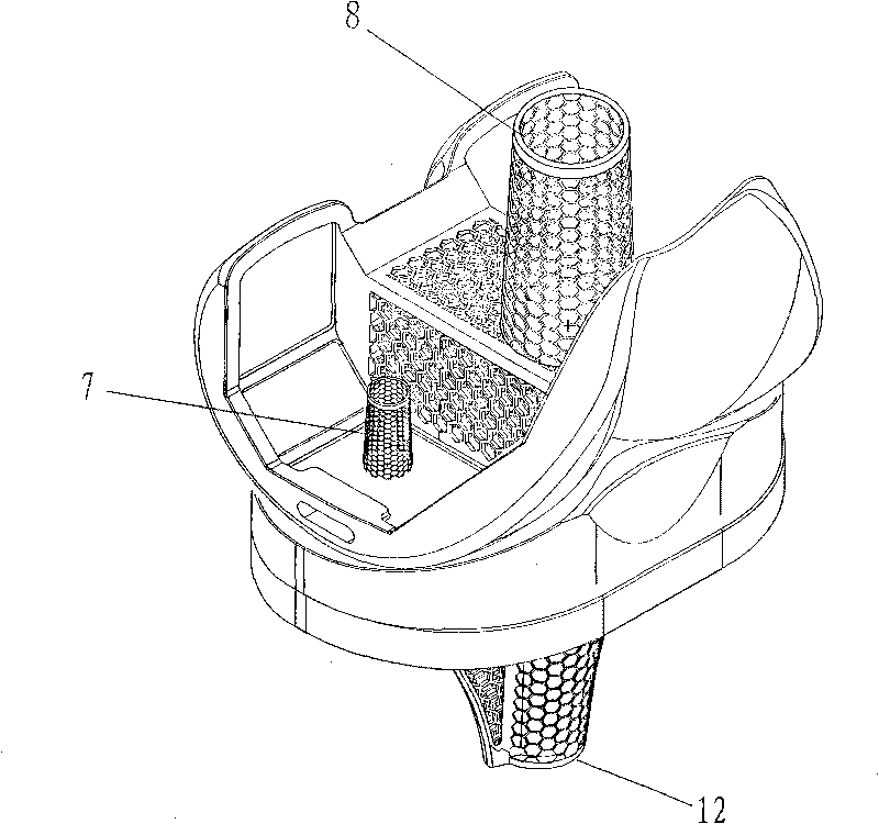 Artificial knee joint bone fusion prosthesis