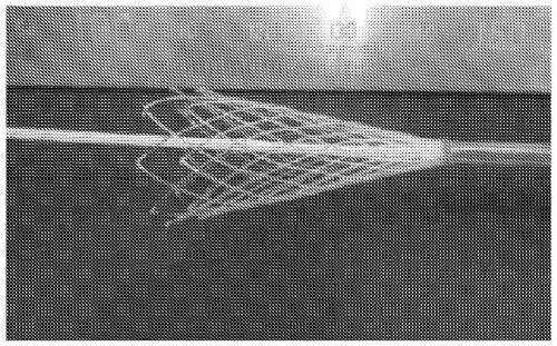 Stent and medical device comprising same