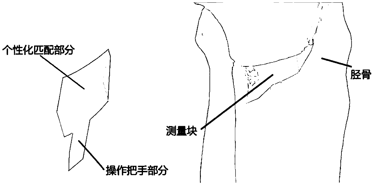 Method for constructing model of personalized high tibial osteotomy angle matching template