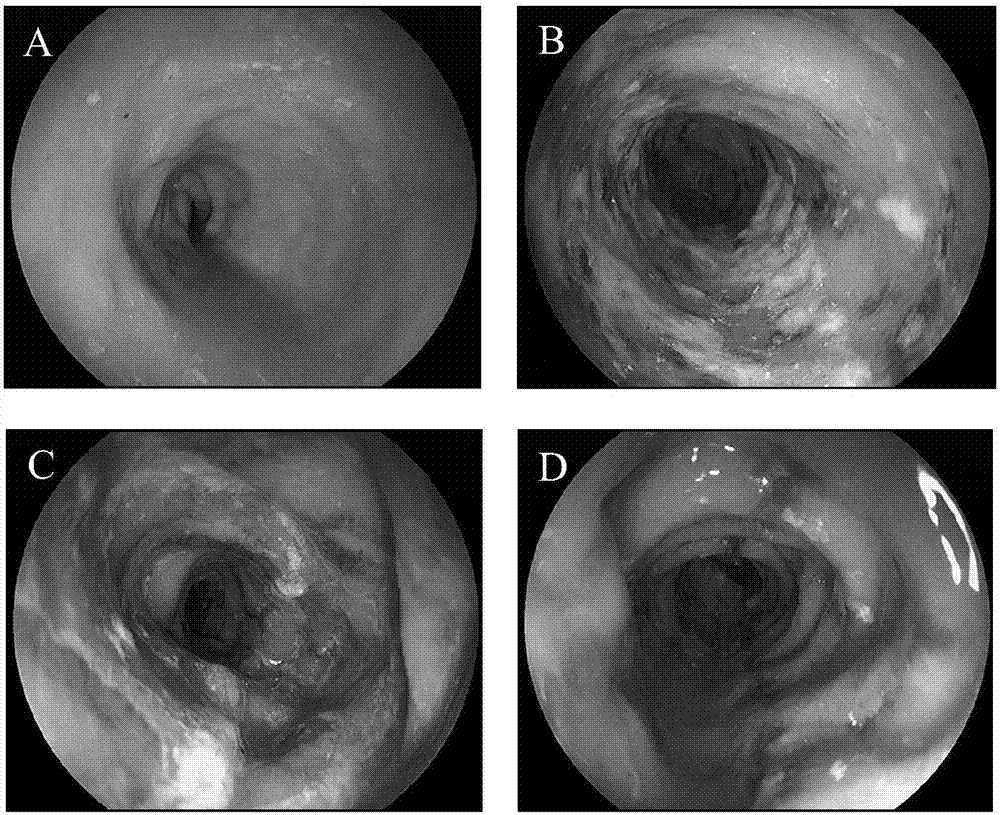 Constructing method and application of ulcerative colitis animal model