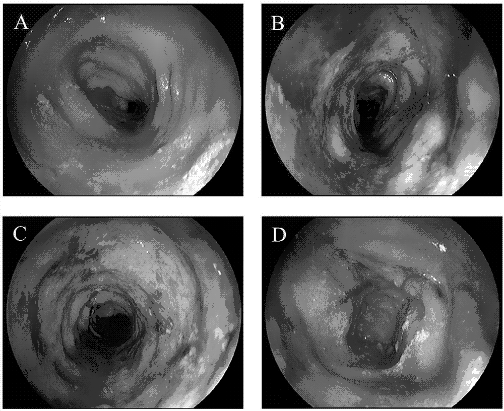 Constructing method and application of ulcerative colitis animal model