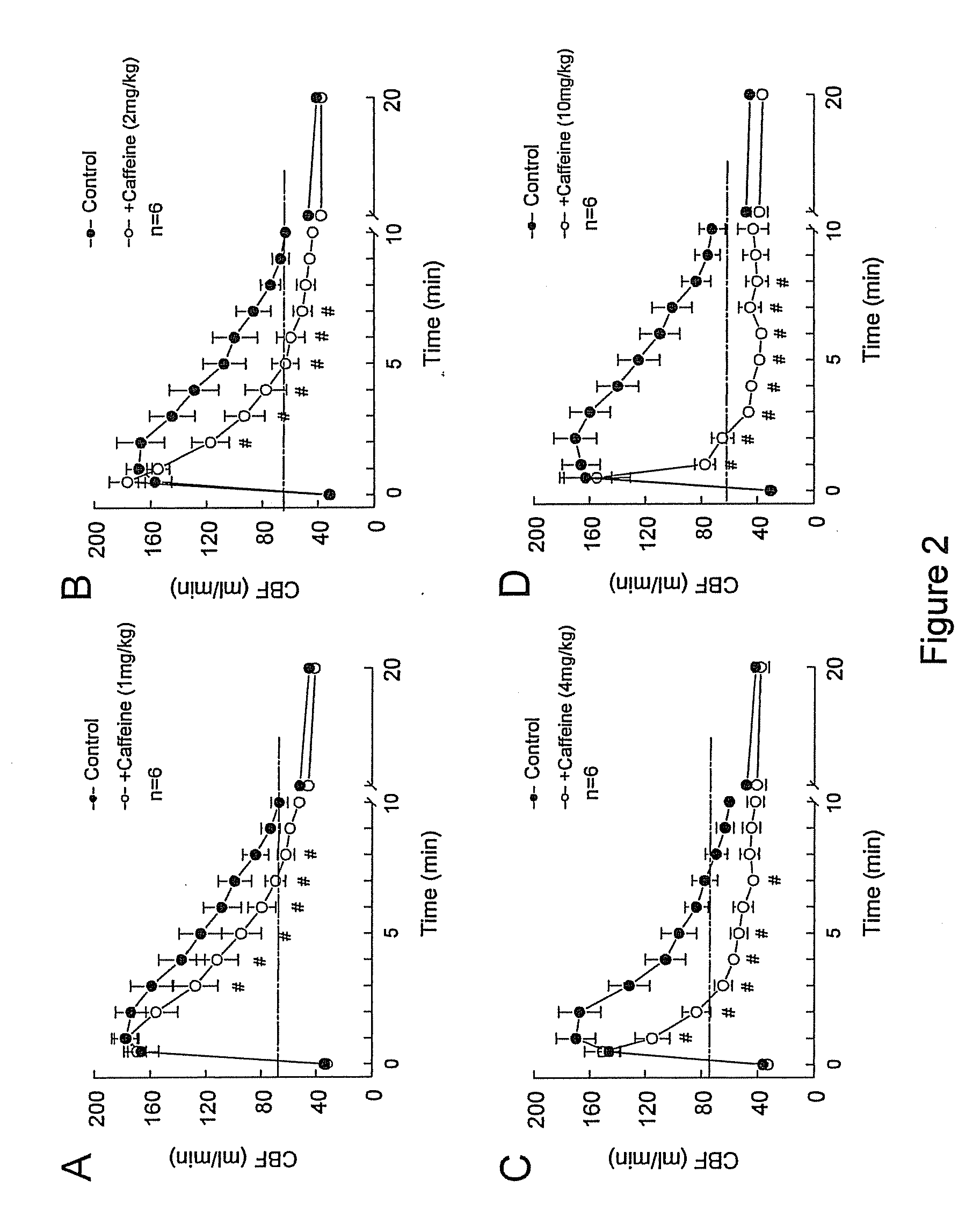 Methods and Compositions for Increasing Patient Tolerability During Myocardial Imaging Methods