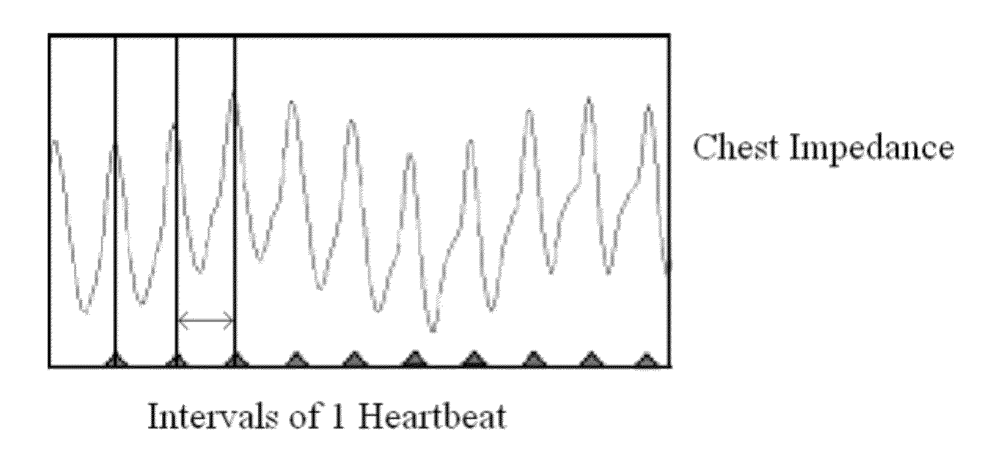 Method and system for detecting apnea