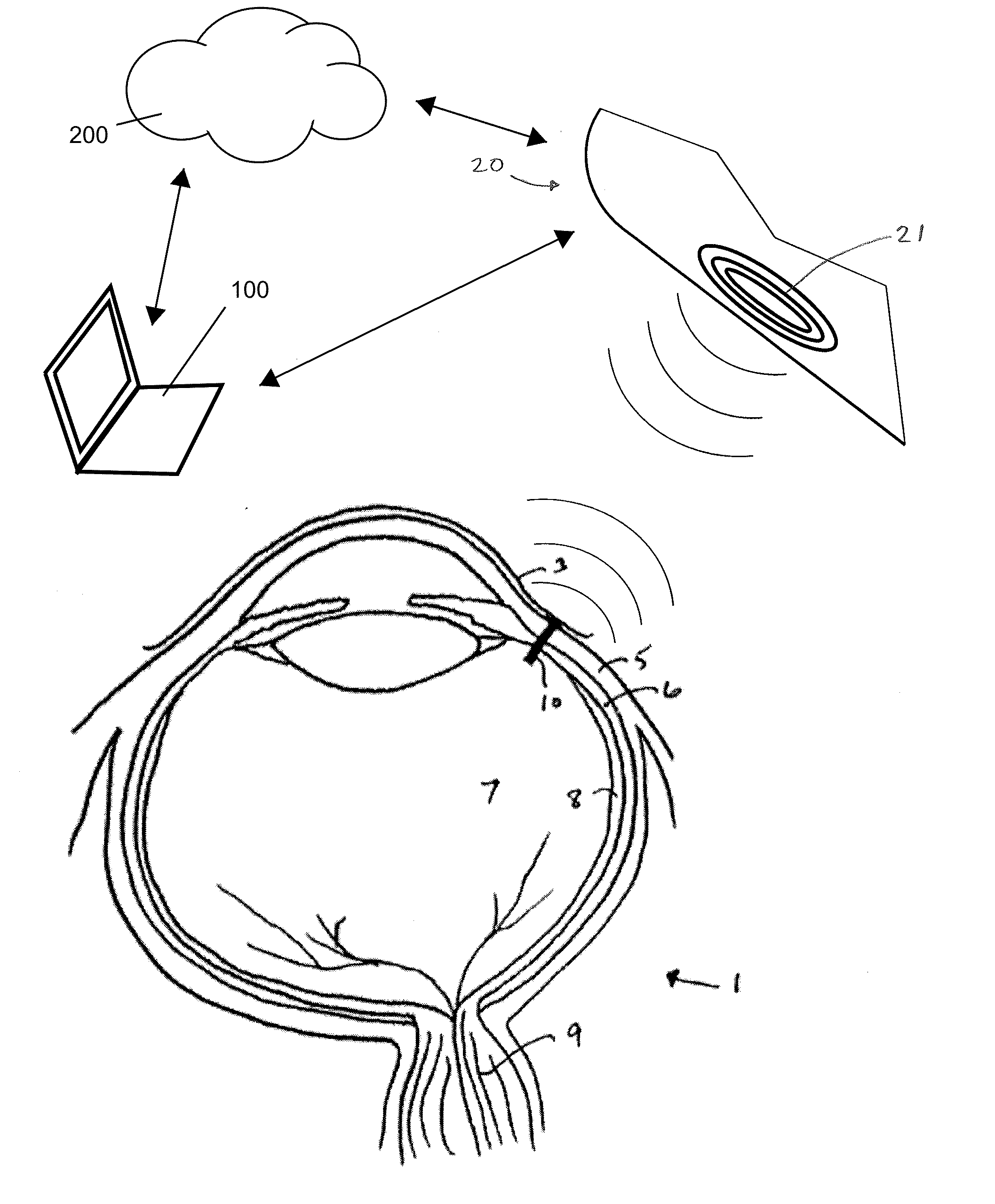 Ultra low power charging implant sensors with wireless interface for patient monitoring