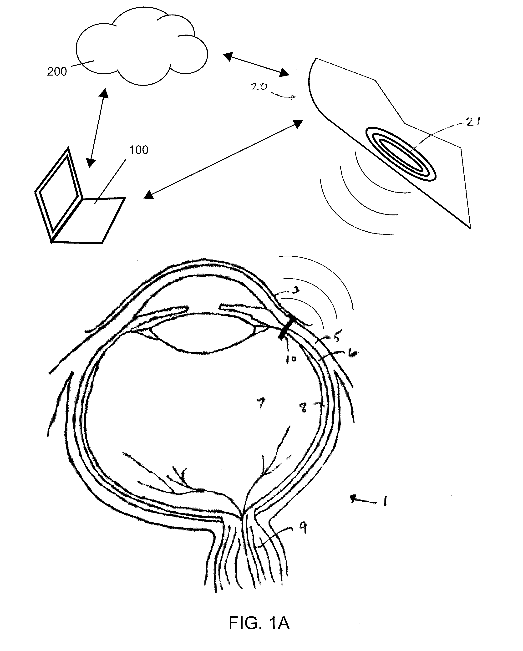 Ultra low power charging implant sensors with wireless interface for patient monitoring