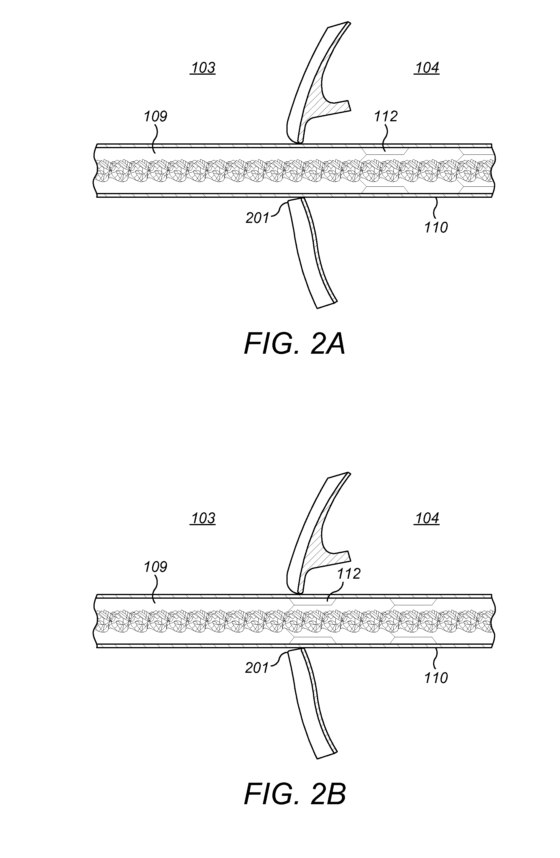 Electrode With Anti-Spring Back Component