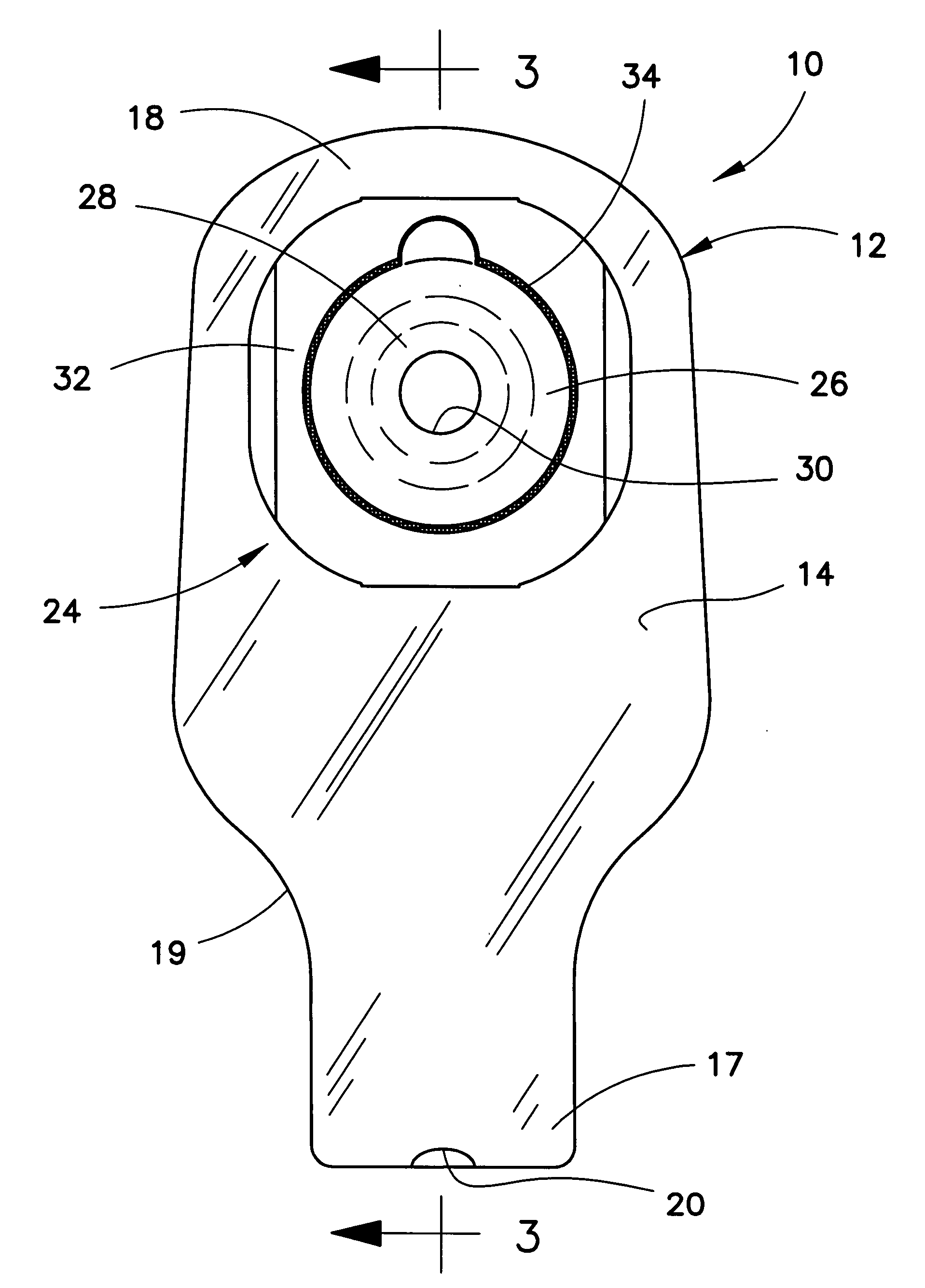 Ostomy pouch