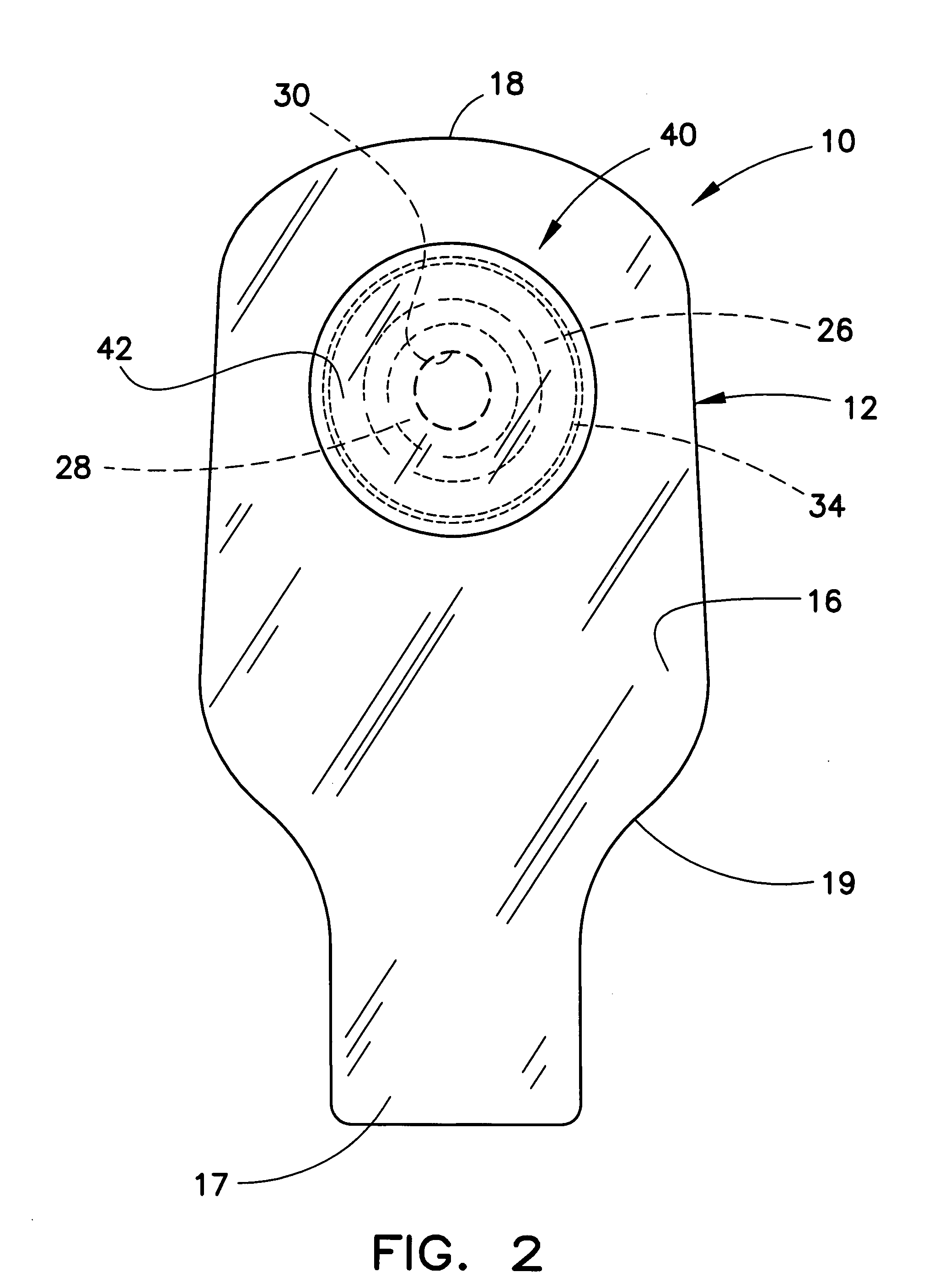 Ostomy pouch