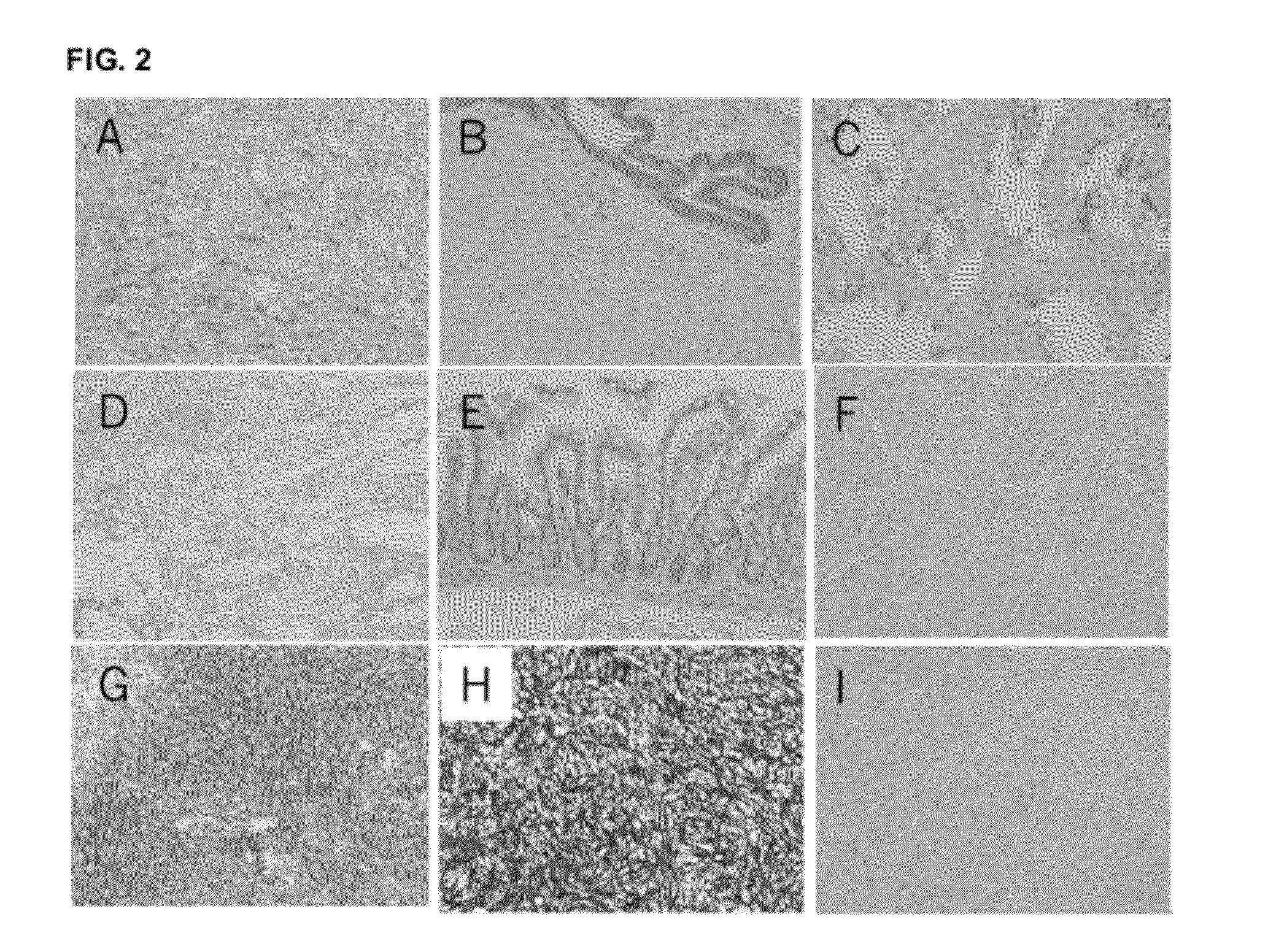 Molecules and methods for modulating tmem16a activities