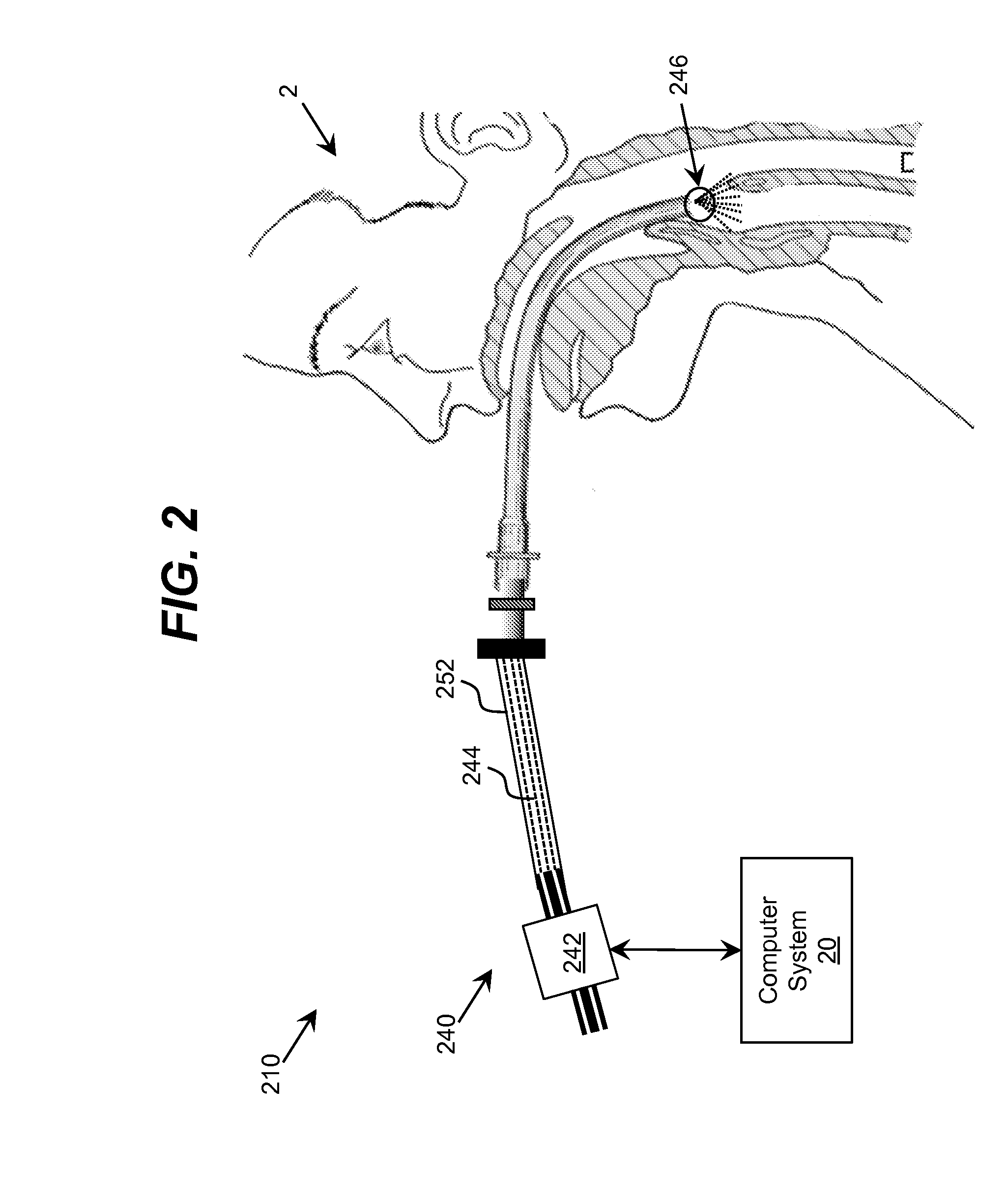 Ultraviolet-Based Sterilization