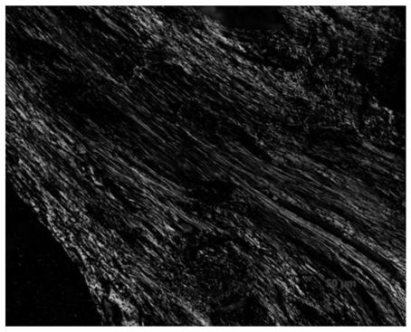 Process for preparing needle coke from medium-low temperature coal tar pitch by four-stage variable-temperature refining one-step method