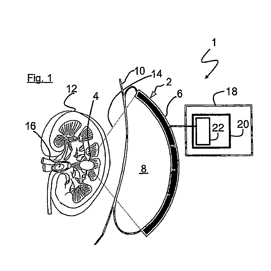 Sound wave treatment device