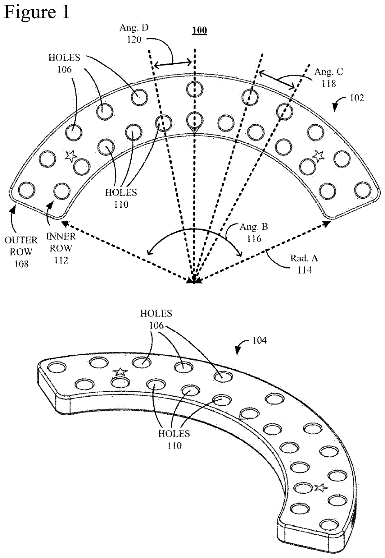 External Fixation for the Correction of Bone Deformity and Trauma