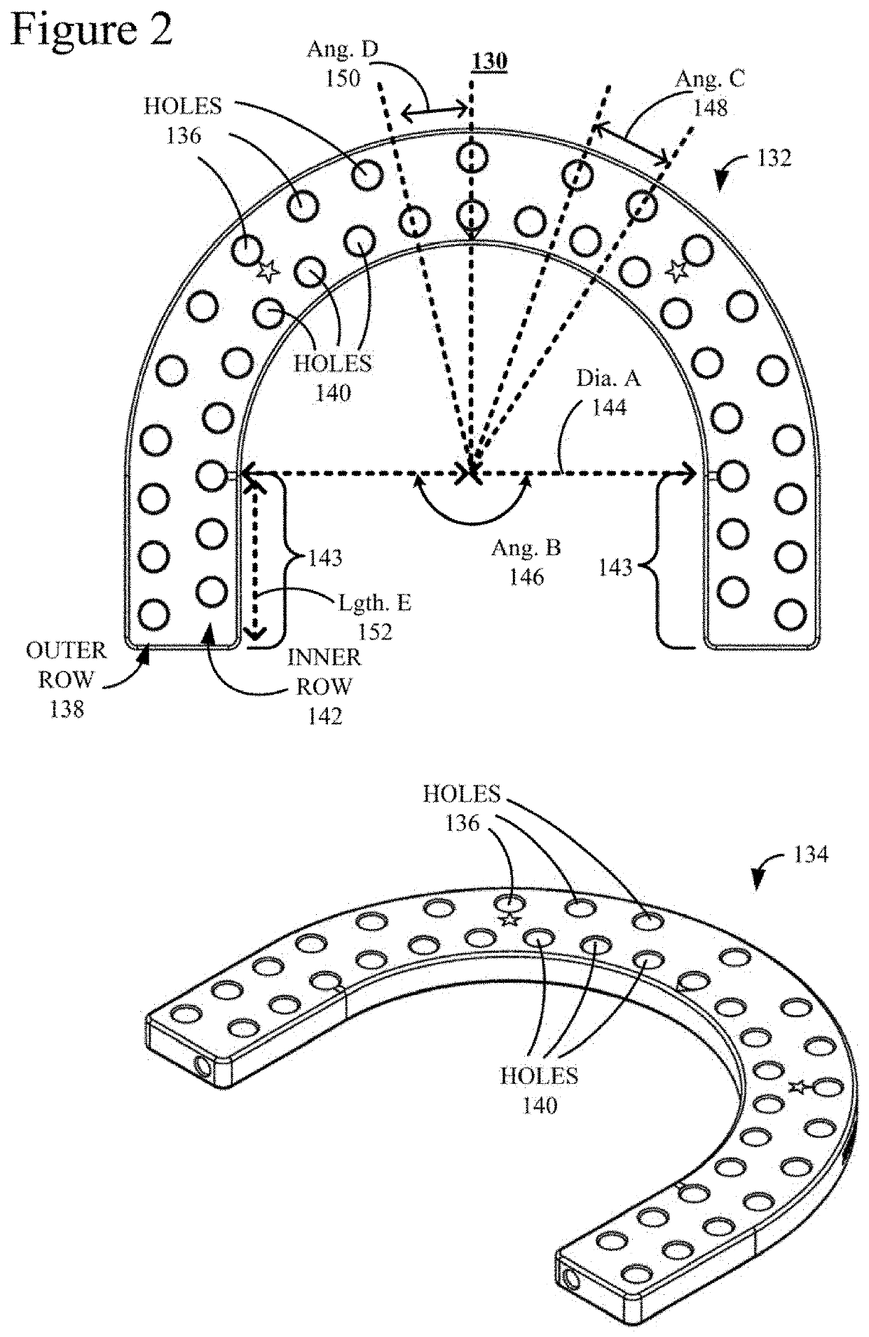 External Fixation for the Correction of Bone Deformity and Trauma