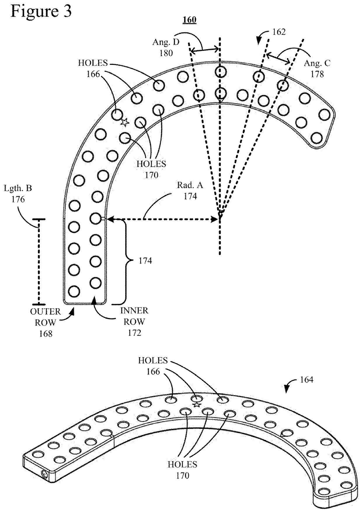 External Fixation for the Correction of Bone Deformity and Trauma