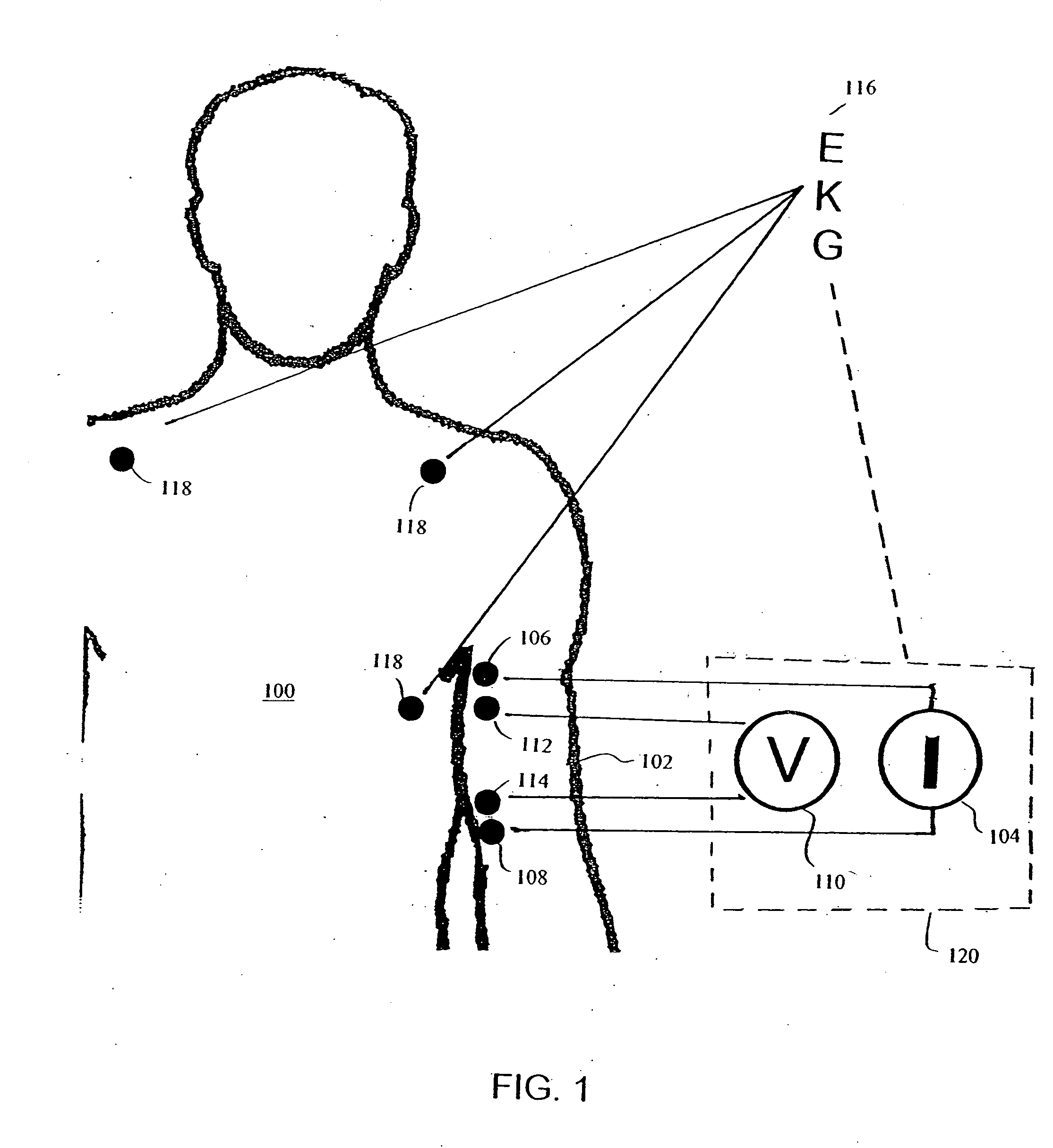 Apparatus and method for determination of stroke volume using the brachial artery