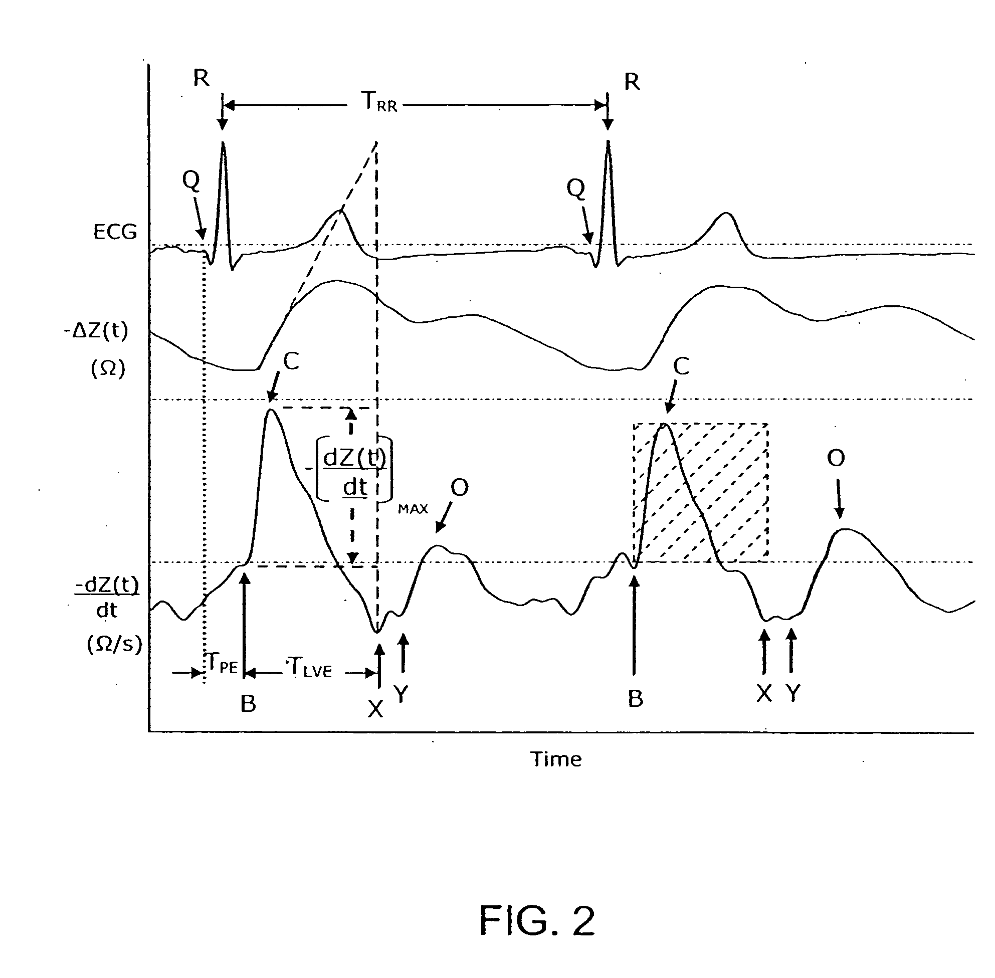 Apparatus and method for determination of stroke volume using the brachial artery