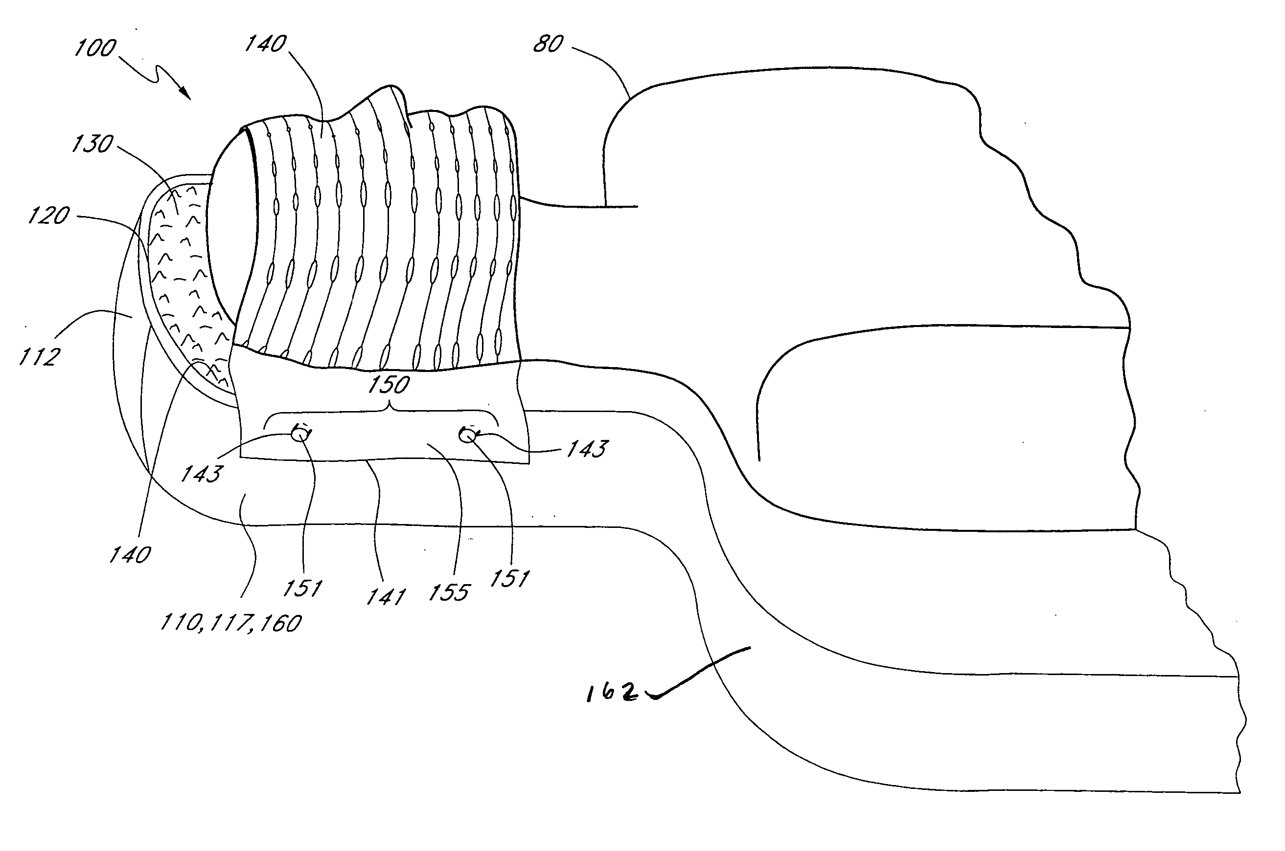 Method and device for registration and immobilization