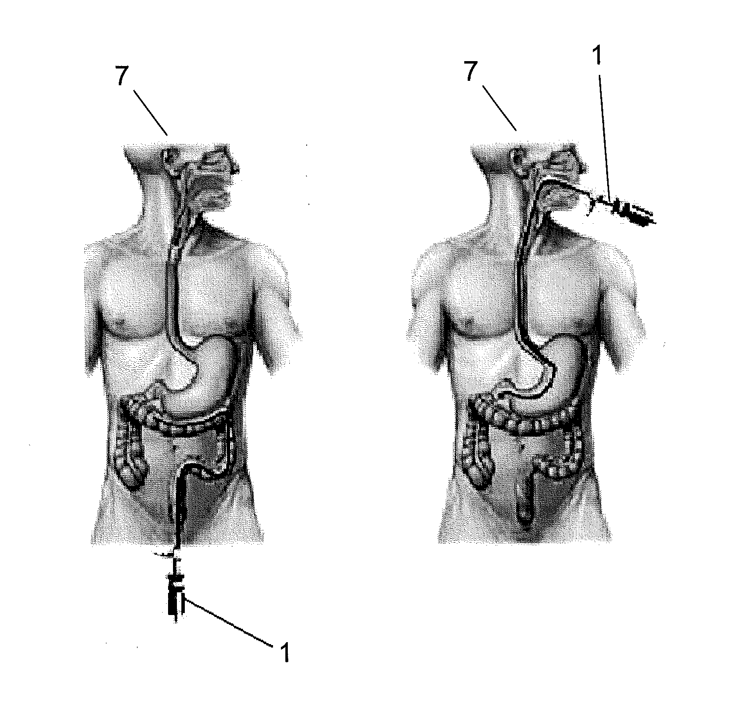 Method, an optical probe and a confocal microscopy system for inspecting a solid organ