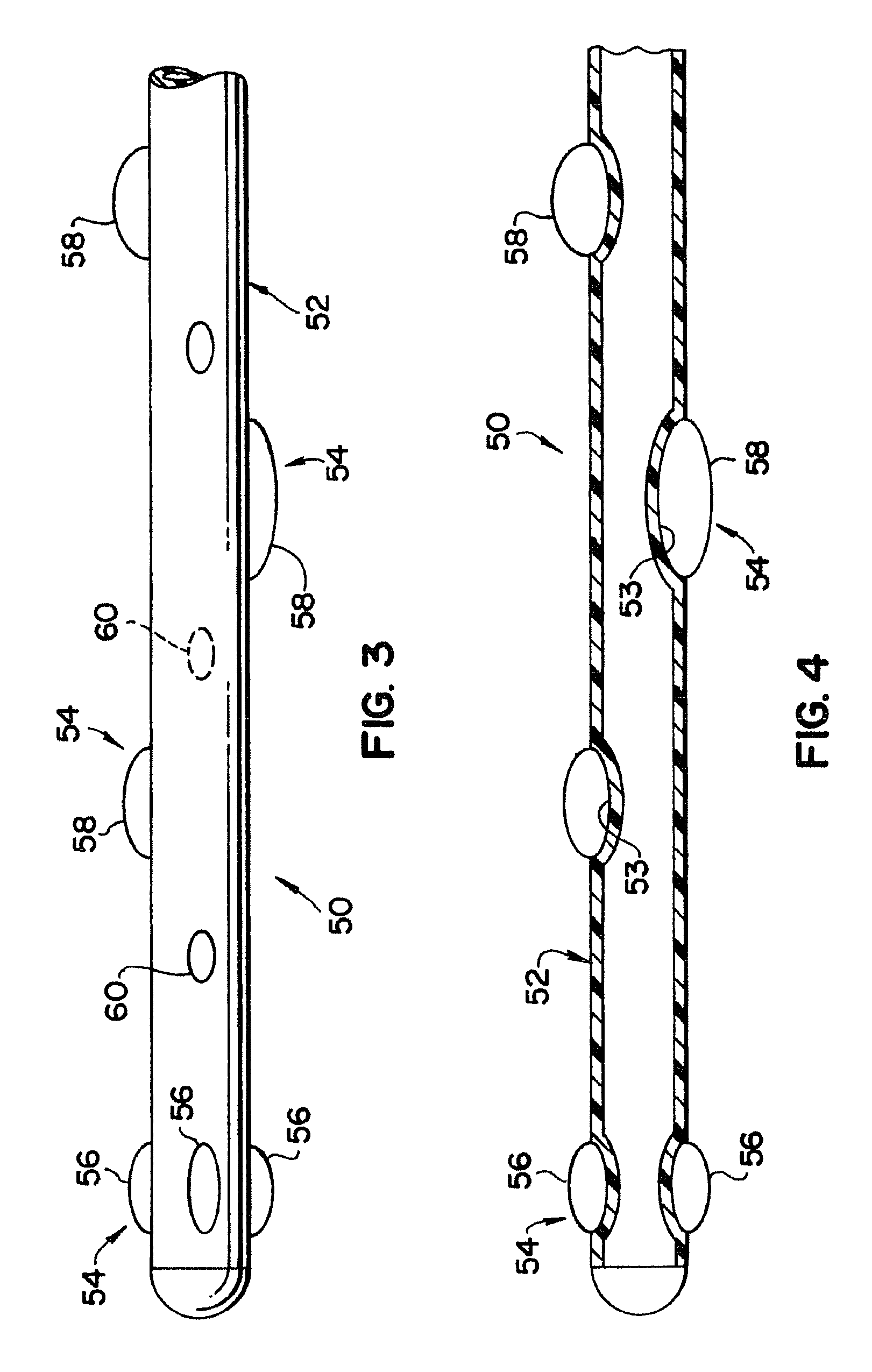 Device with removable projections