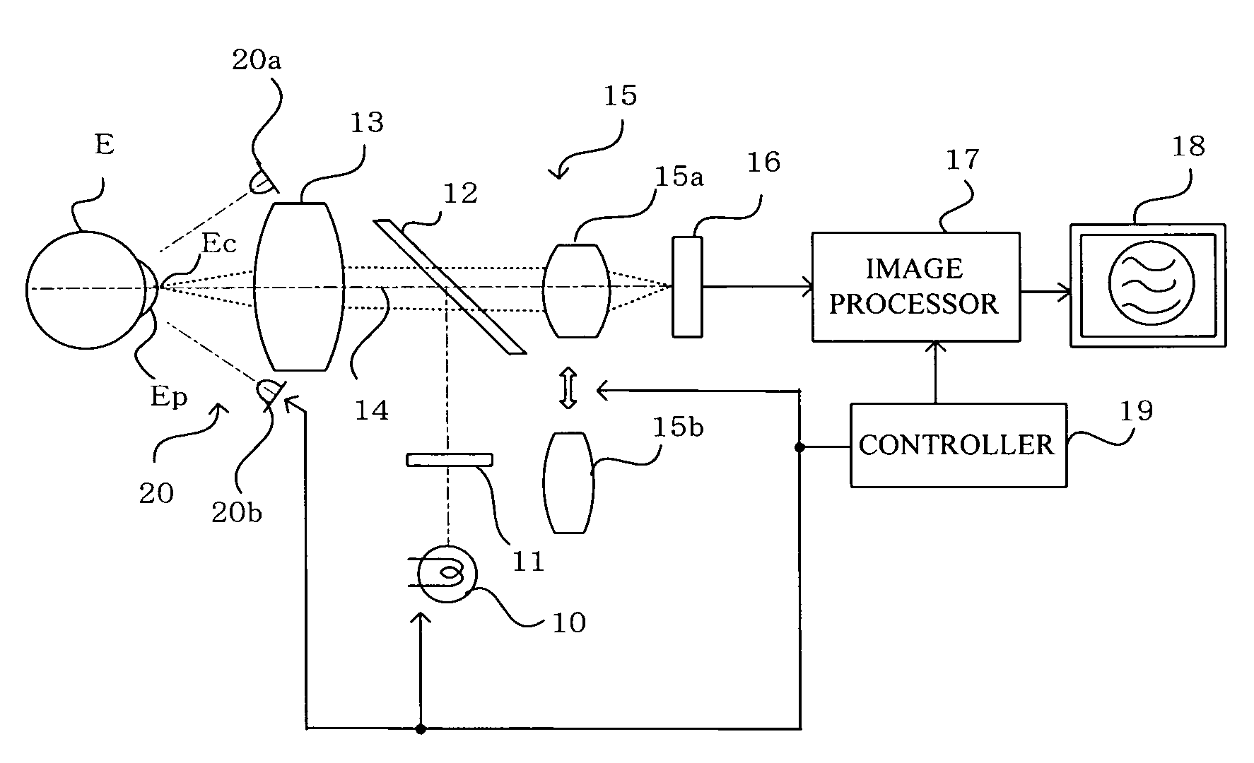 Ophthalmic photography apparatus