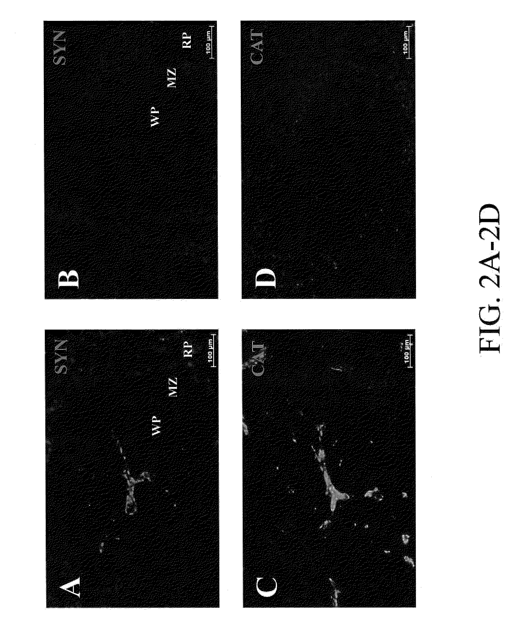 Methods and systems for reducing inflammation by neuromodulation of T-cell activity