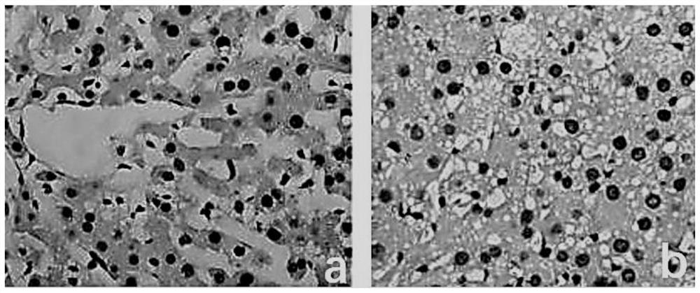 A normal temperature mechanical perfusion system that can expand the source of liver donors