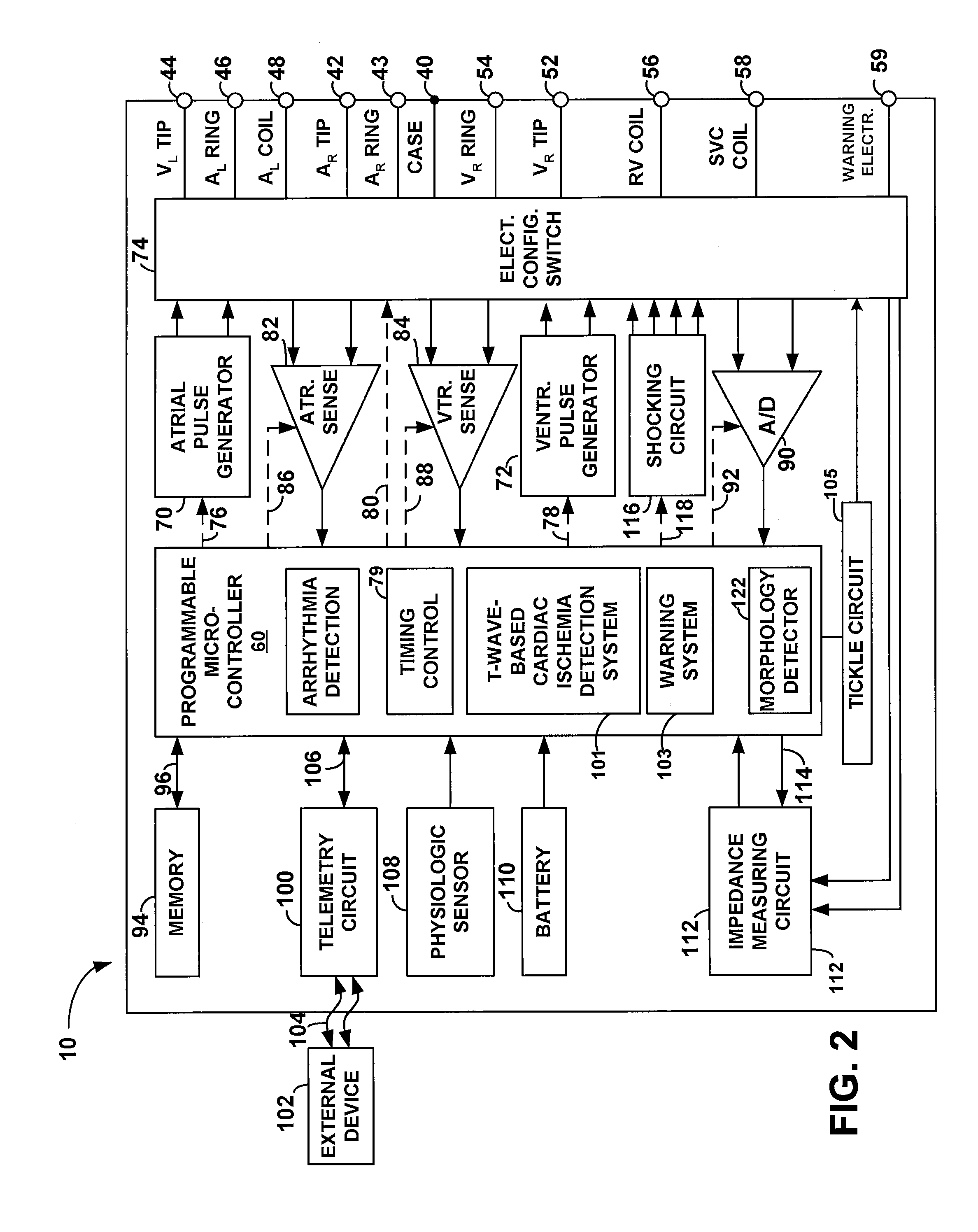 System and method for detecting cardiac ischemia based on t-waves using an implantable medical device