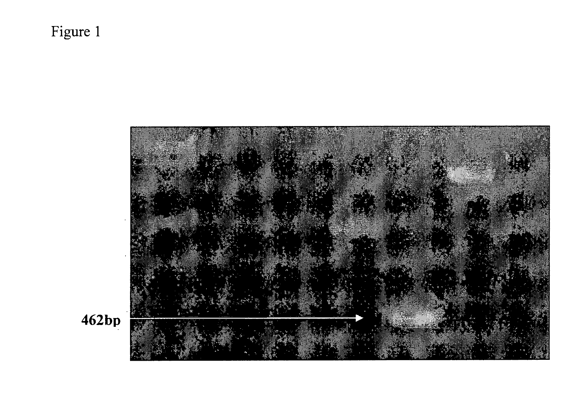 GLUTAMYL tRNA SYNTHETASE (GtS) FRAGMENTS