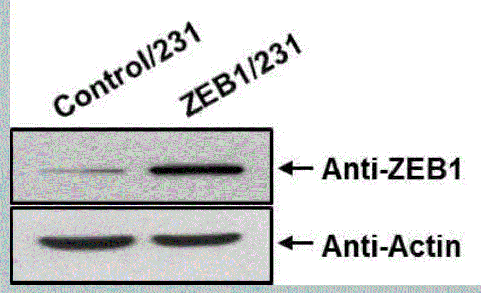 Application of transcription factor ZEB1 for preparing medicine capable of accelerating breast cancer chemosensitivity