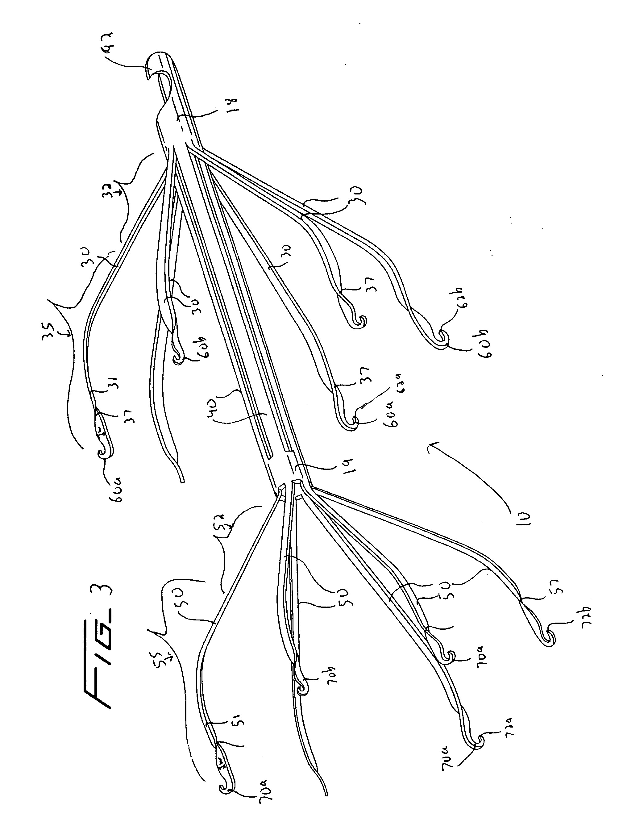 Vein filter