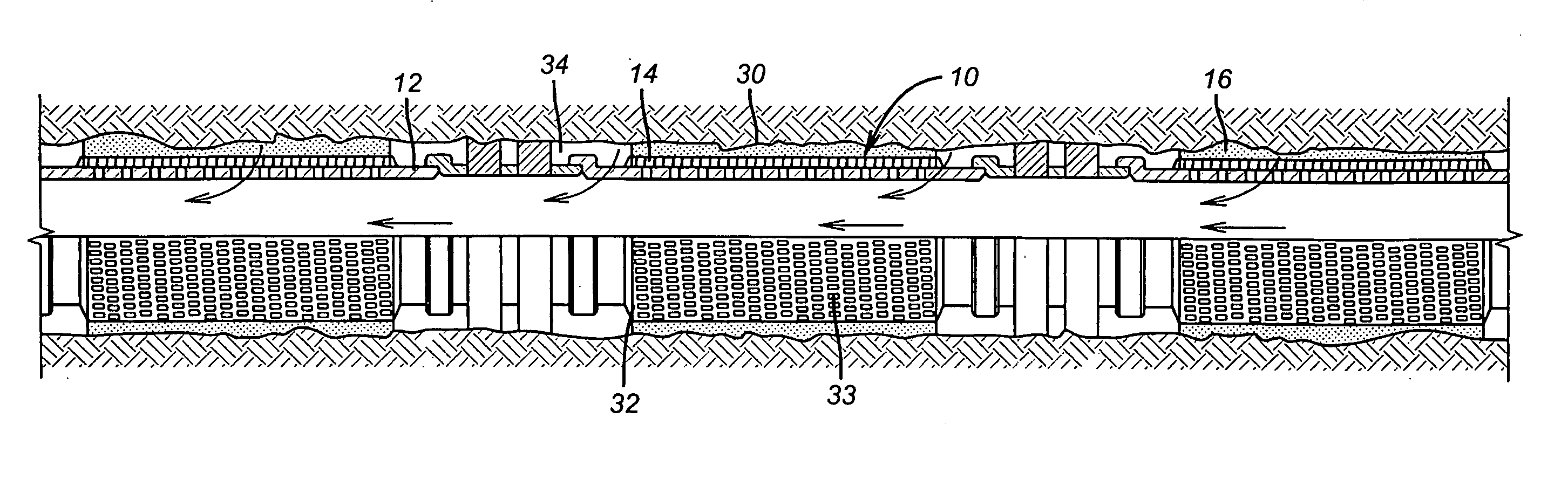 Self-conforming screen