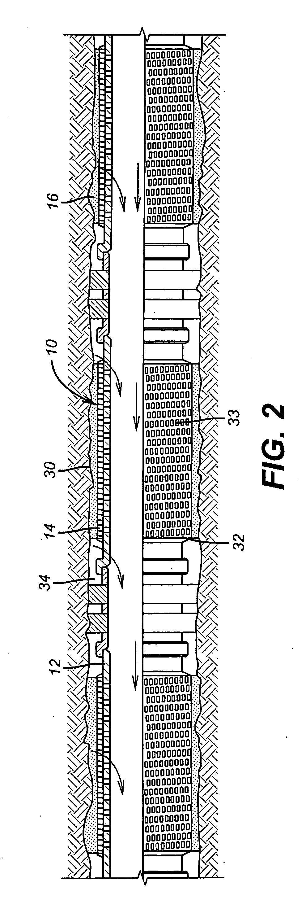 Self-conforming screen