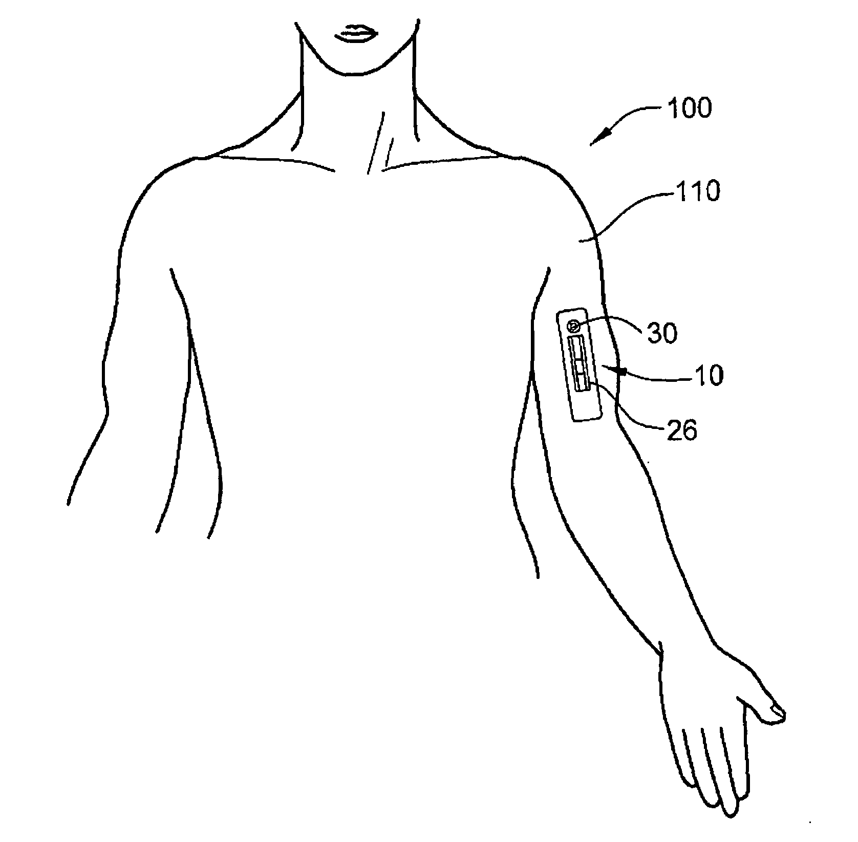 Diagnostic patch