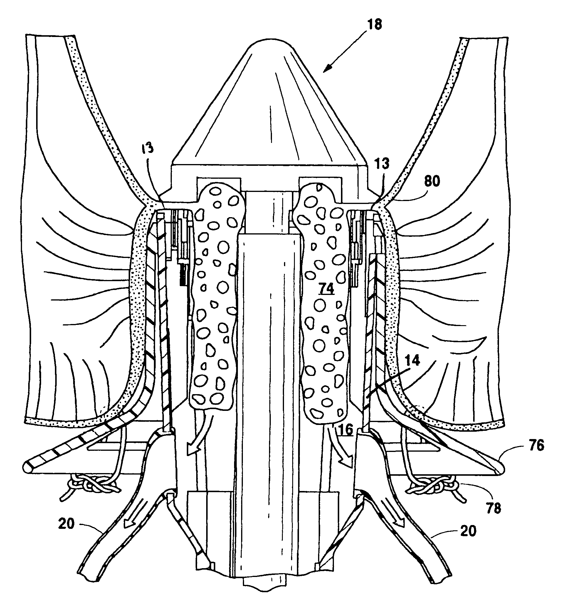 Apparatus and method of use of a circular surgical stapler