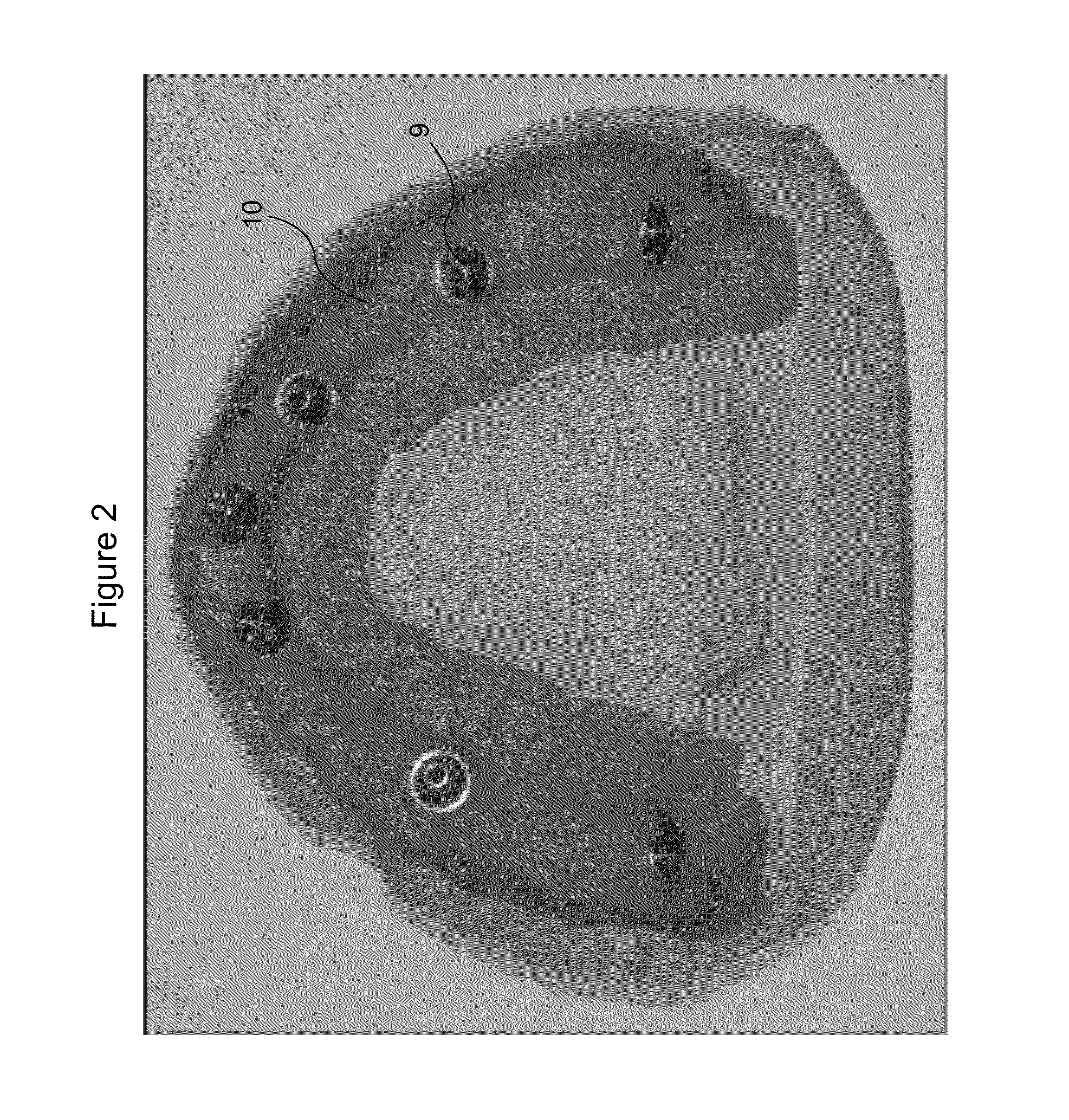 Dental prosthesis and method of its production utilizing standardized framework keys and matching premanufactured teeth