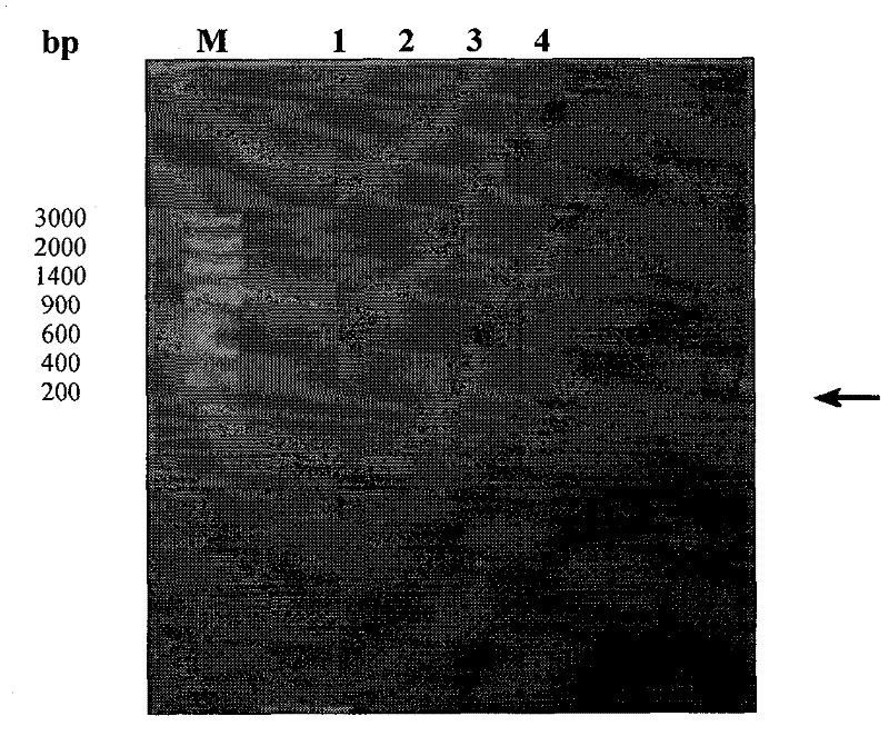 Specific antigen of clonorchis sinensis and application thereof