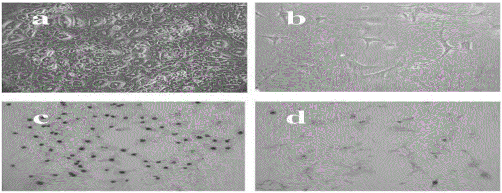 Preparation method for hydroxyethyl chitosan in-situ hydrogel