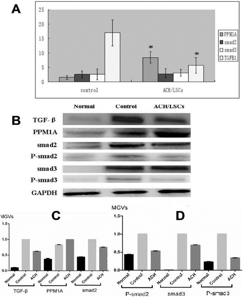 Preparation method for hydroxyethyl chitosan in-situ hydrogel