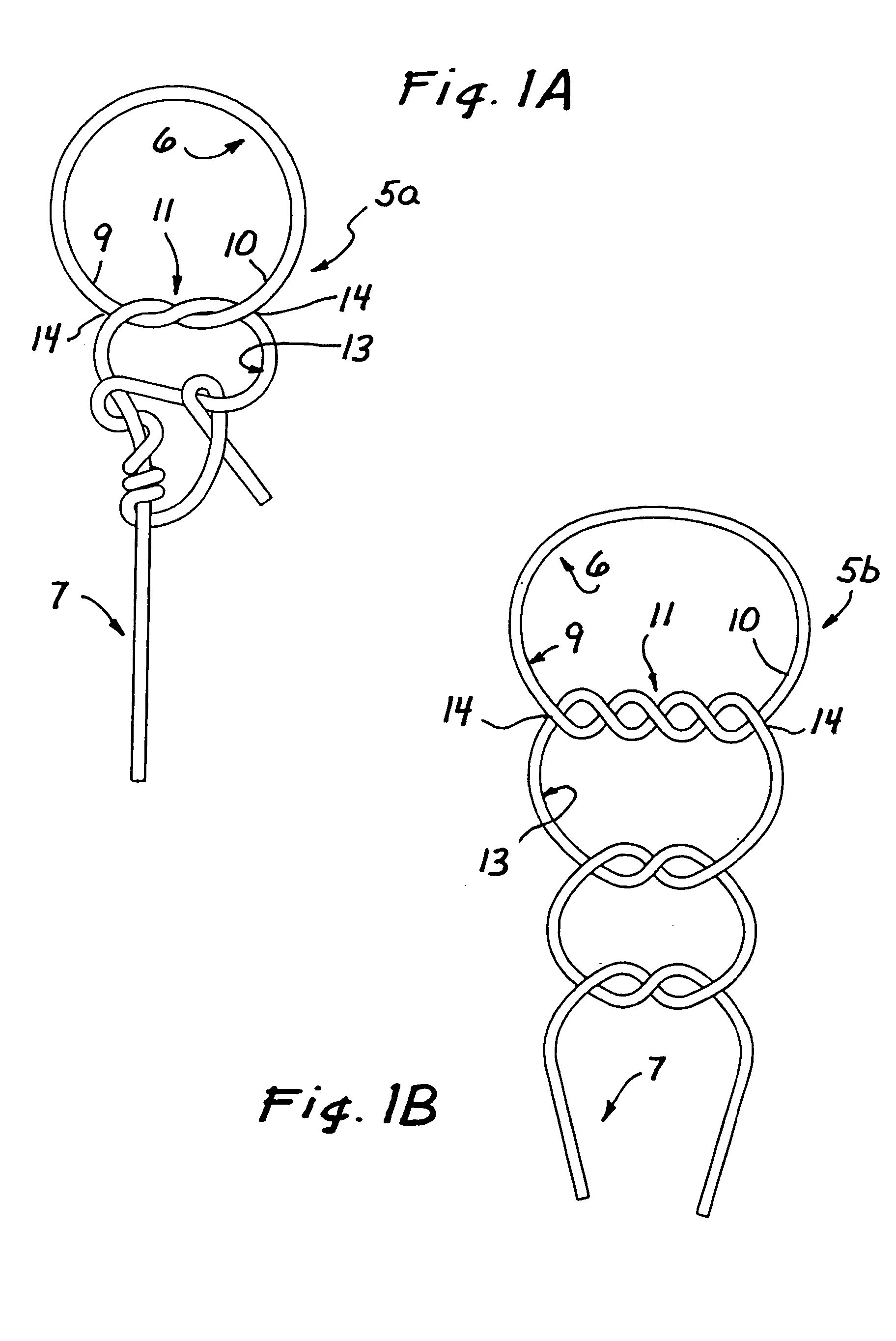 Interlocking suture clinch