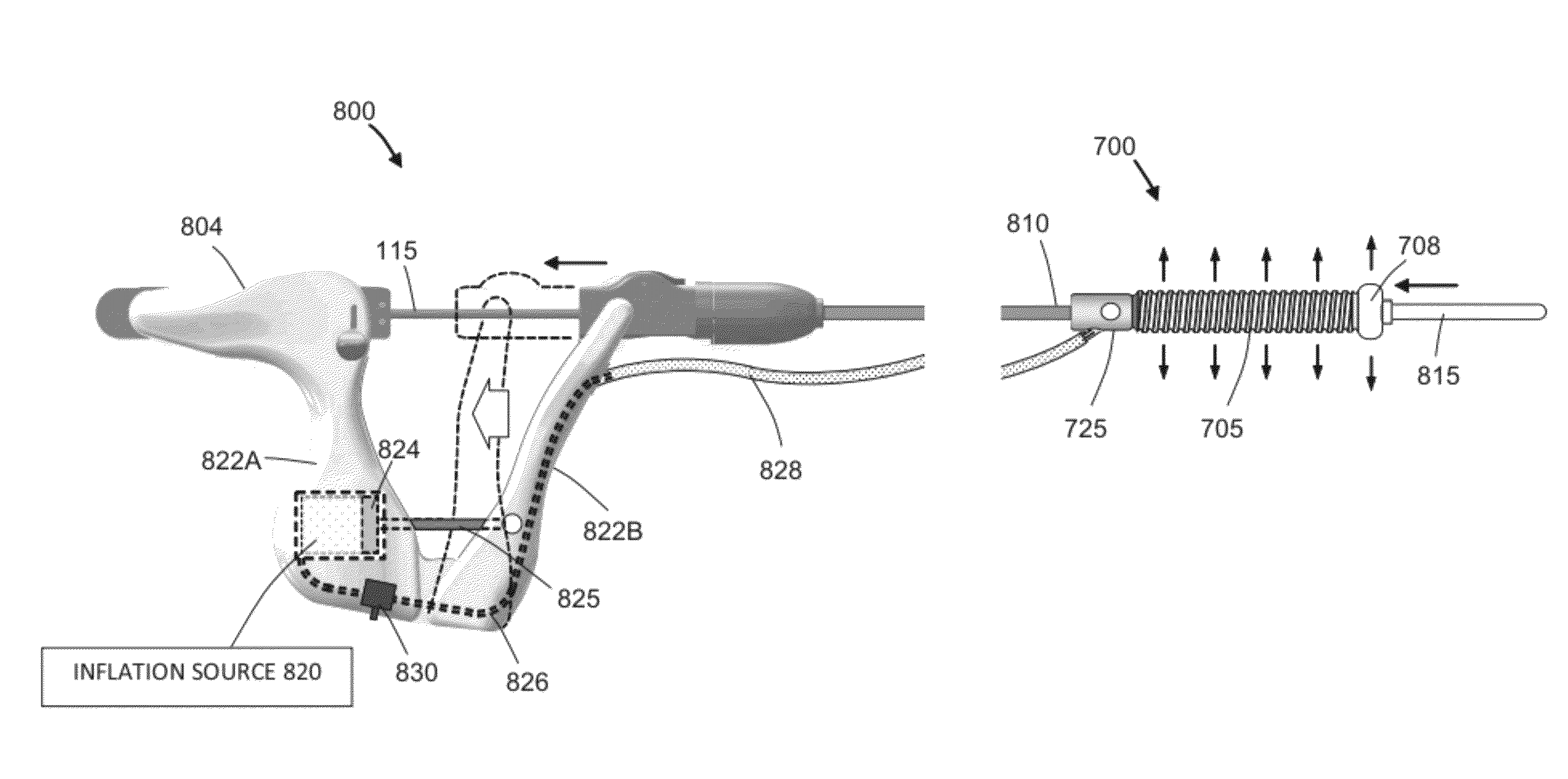 Systems and methods for endometrial ablation