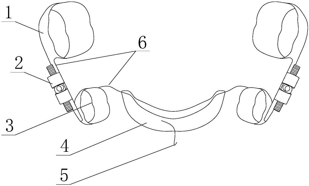 Molar orthodontic appliance capable of conveniently applying orthodontic force