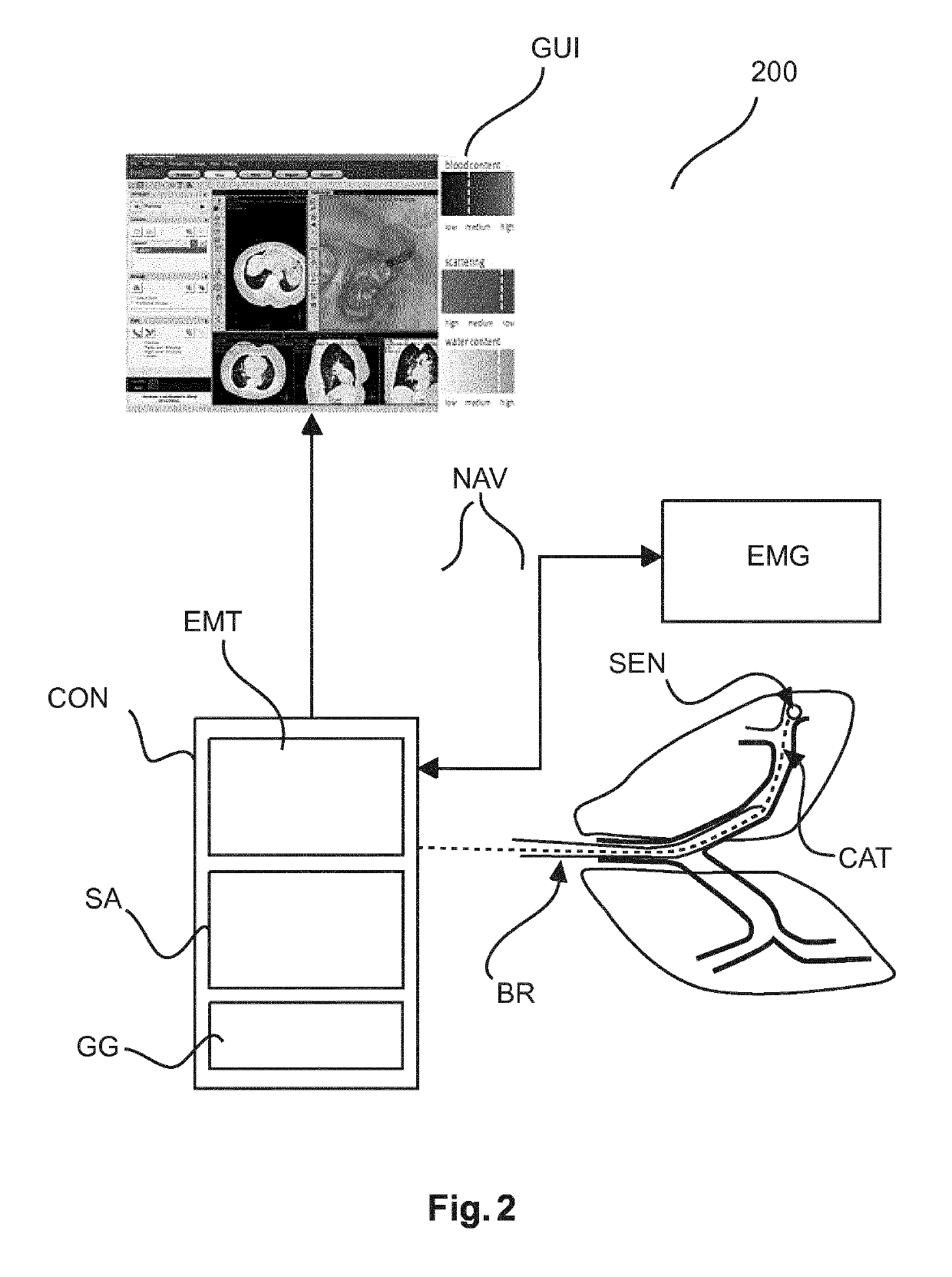 User interface for photonic tools and electromagnetic tracking guided bronchoscope