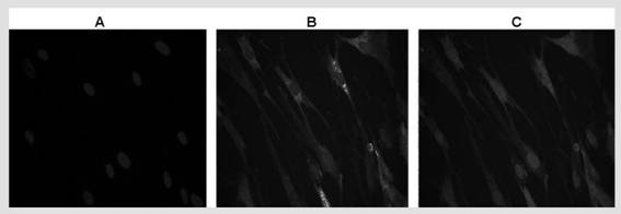 Use of kappa-opioid receptor agonist u50,488h in the preparation of medicines for treating vascular calcification