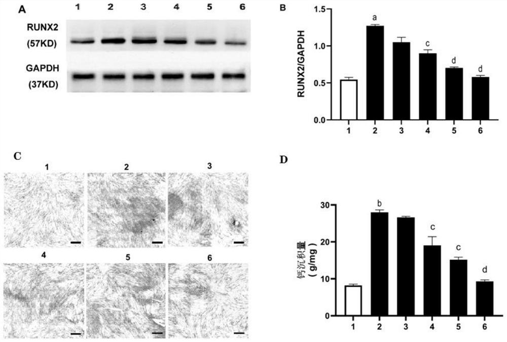 Use of kappa-opioid receptor agonist u50,488h in the preparation of medicines for treating vascular calcification